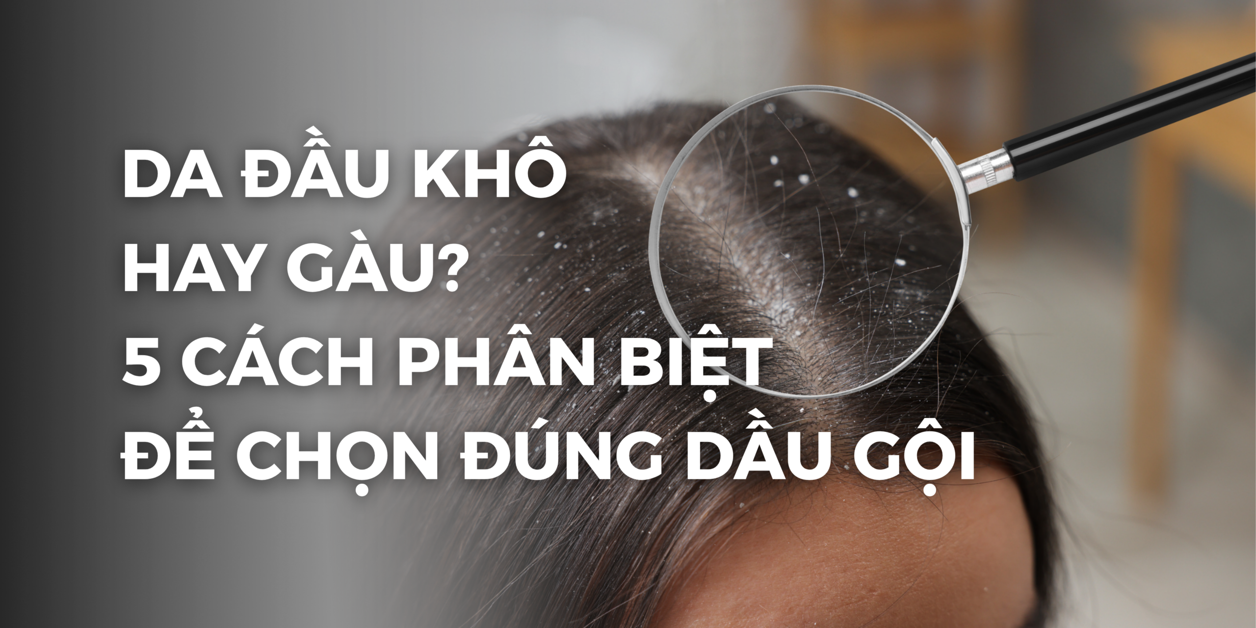 Phân biệt da đầu khô và da đầu dầu